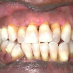 Cosmetic Dentistry: Before Image